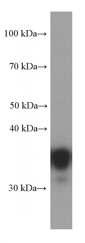 Jurkat cells were subjected to SDS PAGE followed by western blot with Catalog No:107148(CDK6 Antibody) at dilution of 1:2000