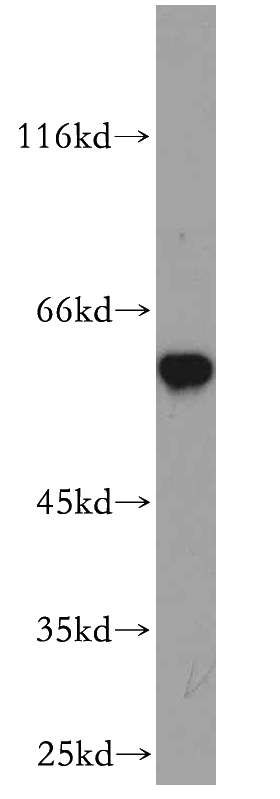 mouse skeletal muscle tissue were subjected to SDS PAGE followed by western blot with Catalog No:109308(cIAP1 antibody) at dilution of 1:1000