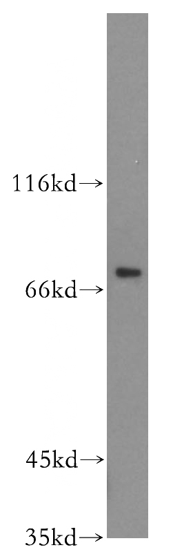 mouse brain tissue were subjected to SDS PAGE followed by western blot with Catalog No:110707(FOXO6 antibody) at dilution of 1:500