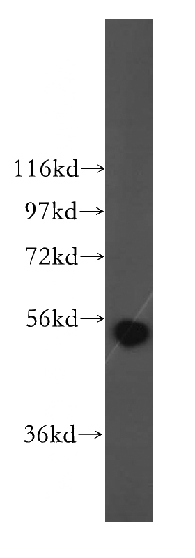HepG2 cells were subjected to SDS PAGE followed by western blot with Catalog No:107963(ALDH1B1 antibody) at dilution of 1:500