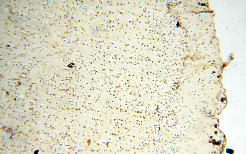 Immunohistochemical of paraffin-embedded human brain using Catalog No:107670(AADACL1 antibody) at dilution of 1:50 (under 10x lens)
