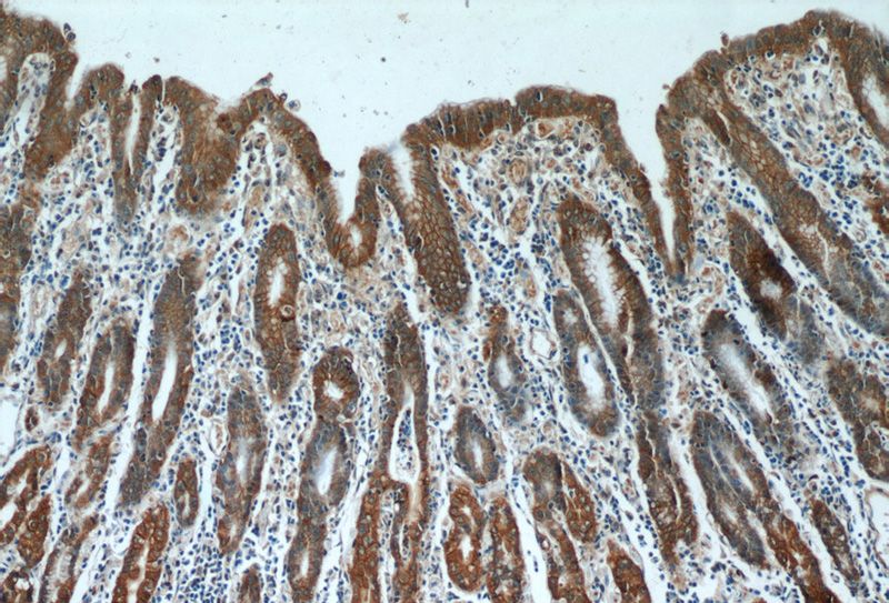 Immunohistochemistry of paraffin-embedded human stomach tissue slide using Catalog No:107869(CTNNA1 Antibody) at dilution of 1:50 (under 10x lens)