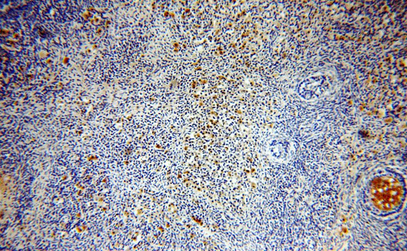 Immunohistochemical of paraffin-embedded human ovary using Catalog No:112253(KTN1 antibody) at dilution of 1:100 (under 10x lens)