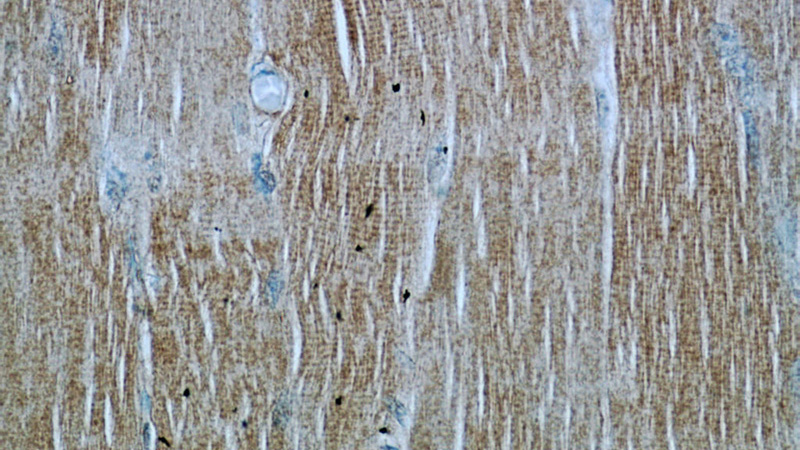 Immunohistochemical of paraffin-embedded human skeletal muscle using Catalog No:110571(FAM13A antibody) at dilution of 1:50 (under 40x lens)