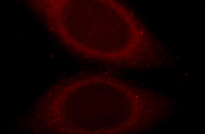 Immunofluorescent analysis of HepG2 cells, using FAM49B antibody Catalog No:110592 at 1:25 dilution and Rhodamine-labeled goat anti-rabbit IgG (red).