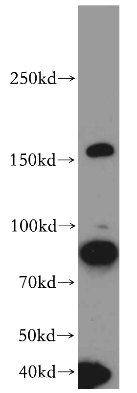 HeLa cells were subjected to SDS PAGE followed by western blot with Catalog No:114778(RocK1-Specific antibody) at dilution of 1:300