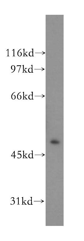 HepG2 cells were subjected to SDS PAGE followed by western blot with Catalog No:109355(CNP antibody) at dilution of 1:500