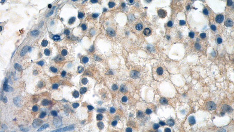 Immunohistochemistry of paraffin-embedded human testis tissue slide using Catalog No:108067(ANKRD13B Antibody) at dilution of 1:50 (under 40x lens)