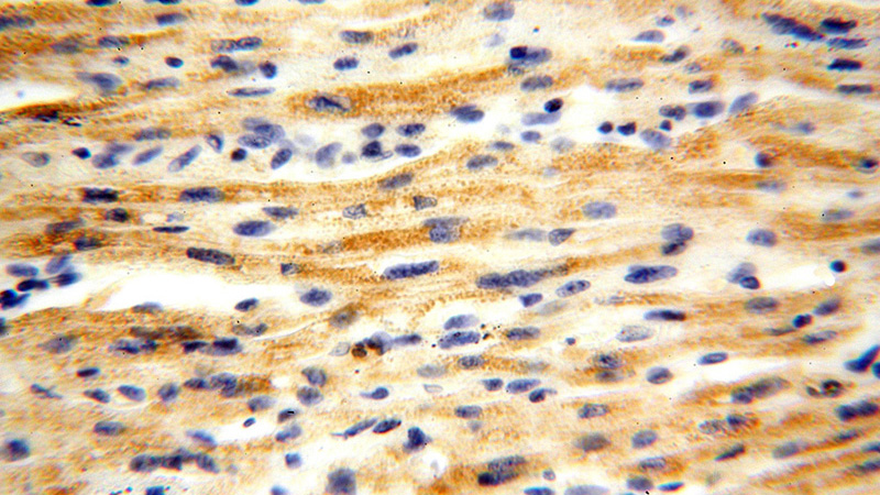 Immunohistochemical of paraffin-embedded human heart using Catalog No:107745(ACOT2 antibody) at dilution of 1:100 (under 40x lens)