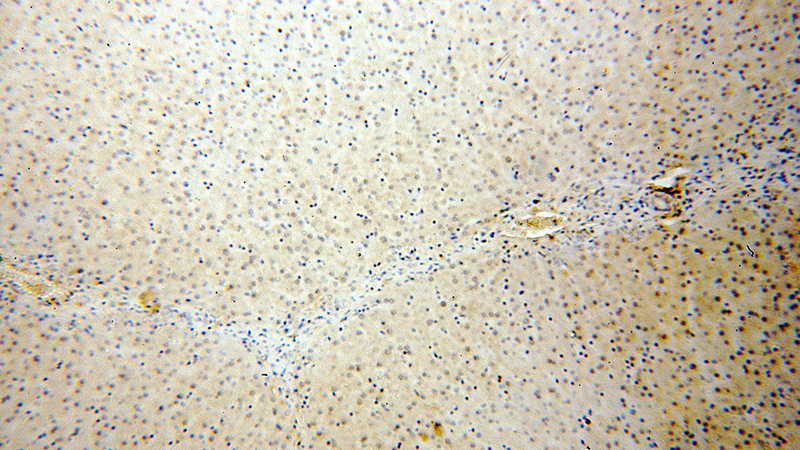 Immunohistochemical of paraffin-embedded human liver using Catalog No:112788(MTMR6 antibody) at dilution of 1:100 (under 10x lens)