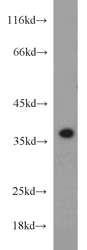 Jurkat cells were subjected to SDS PAGE followed by western blot with Catalog No:108926(CAMLG antibody) at dilution of 1:1000