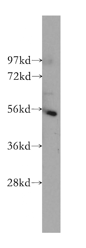 HeLa cells were subjected to SDS PAGE followed by western blot with Catalog No:111647(IKZF1 antibody) at dilution of 1:500