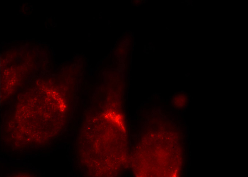 Immunofluorescent analysis of HeLa cells using Catalog No:108072(ANKRD26 Antibody) at dilution of 1:25 and Rhodamine-Goat anti-Rabbit IgG