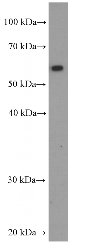 Jurkat cells were subjected to SDS PAGE followed by western blot with Catalog No:107261(HEXA Antibody) at dilution of 1:16000