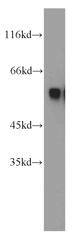 mouse brain tissue were subjected to SDS PAGE followed by western blot with Catalog No:113918(PKMYT1 antibody) at dilution of 1:500