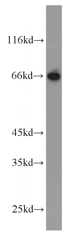 mouse liver tissue were subjected to SDS PAGE followed by western blot with Catalog No:111433(HLF antibody) at dilution of 1:800