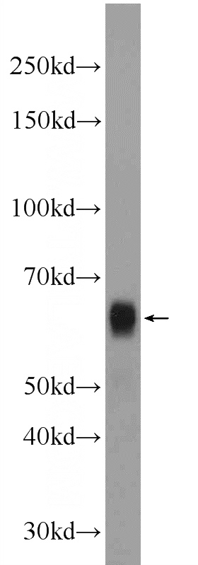 HEK-293 cells were subjected to SDS PAGE followed by western blot with Catalog No:117101(BCL3 Antibody) at dilution of 1:600