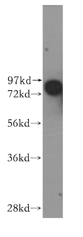 human brain tissue were subjected to SDS PAGE followed by western blot with Catalog No:109425(CNKSR1 antibody) at dilution of 1:400