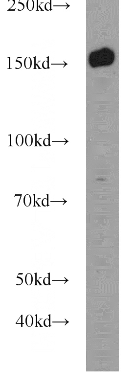 Y79 cells were subjected to SDS PAGE followed by western blot with Catalog No:117109(BCR antibody) at dilution of 1:1000