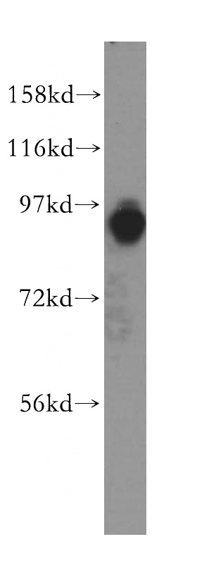 Jurkat cells were subjected to SDS PAGE followed by western blot with Catalog No:107726(ACAP3 antibody) at dilution of 1:500