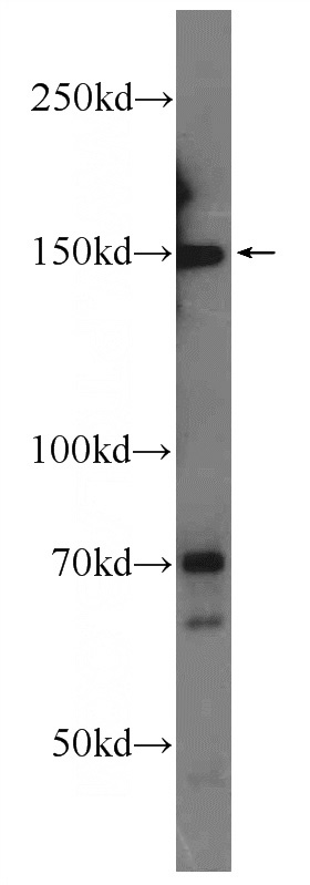 Jurkat cells were subjected to SDS PAGE followed by western blot with Catalog No:108279(ATAD5 Antibody) at dilution of 1:600