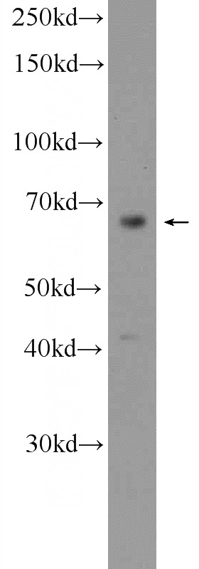 mouse brain tissue were subjected to SDS PAGE followed by western blot with Catalog No:112433(MAPK4 Antibody) at dilution of 1:300