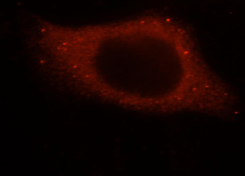 Immunofluorescent analysis of HepG2 cells, using SMAP2 antibody Catalog No:115426 at 1:25 dilution and Rhodamine-labeled goat anti-rabbit IgG (red).