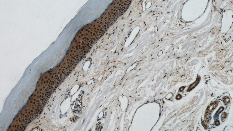 Immunohistochemical of paraffin-embedded human skin using Catalog No:112734(MORF4L1 antibody) at dilution of 1:100 (under 10x lens)