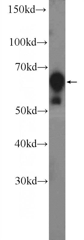 HEK-293 cells were subjected to SDS PAGE followed by western blot with Catalog No:111201(GRB7 Antibody) at dilution of 1:1000