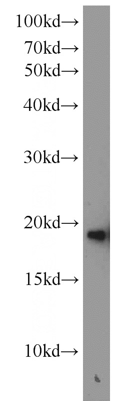 mouse brain tissue were subjected to SDS PAGE followed by western blot with Catalog No:115451(SNCB antibody) at dilution of 1:600