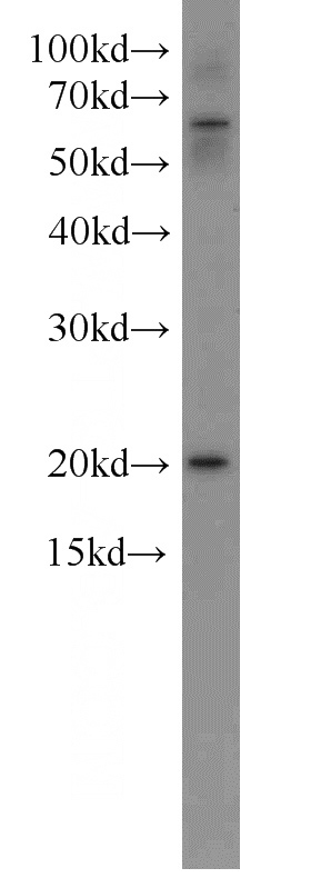 Jurkat cells were subjected to SDS PAGE followed by western blot with Catalog No:113271(NRAS antibody) at dilution of 1:500