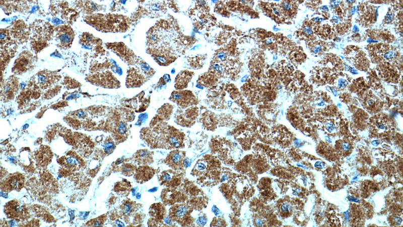 Immunohistochemical of paraffin-embedded human heart using Catalog No:115013(SCO2 antibody) at dilution of 1:50 (under 40x lens)