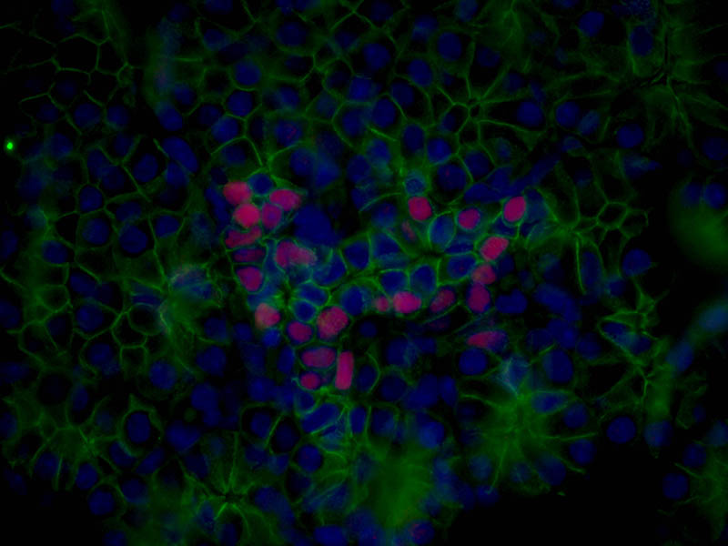IF result (trunk or trunck-associated region; nucleus stain; RED) of NKX2-2 antibody (Catalog No:113203) with E16.5 mouse pancreas by Dr. Nicholas George, Sarvetnick Lab – UNMC. (Green, E-Cadherin; RED, NKX2-2; Blue, DAPI)