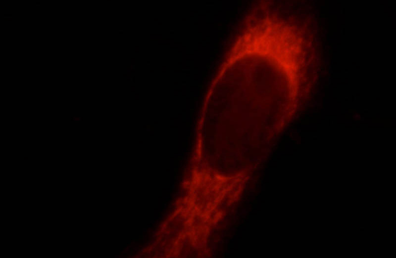 Immunofluorescent analysis of HeLa cells using Catalog No:117311(COXIV Antibody) at dilution of 1:25 and Rhodamine-Goat anti-Mouse IgG