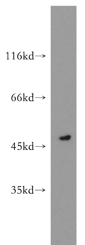 human heart tissue were subjected to SDS PAGE followed by western blot with Catalog No:113528(OXSM antibody) at dilution of 1:800