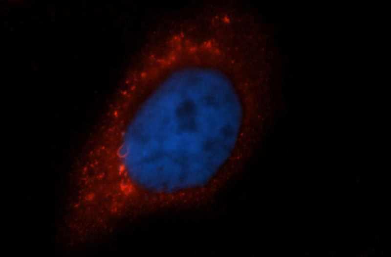 Immunofluorescent analysis of Hela cells, using BLMH antibody Catalog No:117186 at 1:50 dilution and Rhodamine-labeled goat anti-rabbit IgG (red). Blue pseudocolor = DAPI (fluorescent DNA dye).