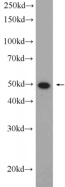 mouse spleen tissue were subjected to SDS PAGE followed by western blot with Catalog No:111836(IRF4 Antibody) at dilution of 1:1000