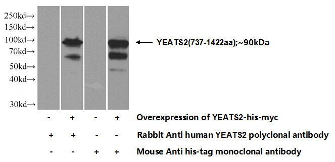 Transfected HEK-293 cells were subjected to SDS PAGE followed by western blot with Catalog No:116883(YEATS2 Antibody) at dilution of 1:700