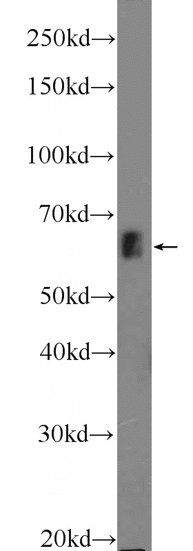 COLO 320 cells were subjected to SDS PAGE followed by western blot with Catalog No:117019(ZNF668 Antibody) at dilution of 1:600