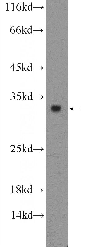 mouse lung tissue were subjected to SDS PAGE followed by western blot with Catalog No:111359(HIST1H1T Antibody) at dilution of 1:300