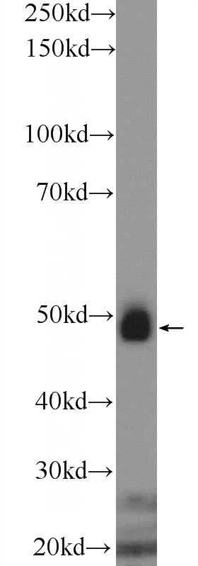 mouse liver tissue were subjected to SDS PAGE followed by western blot with Catalog No:108231(ASL Antibody) at dilution of 1:300