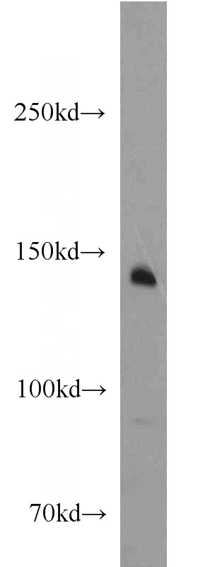 mouse lung tissue were subjected to SDS PAGE followed by western blot with Catalog No:114785(RON, MST1R antibody) at dilution of 1:300
