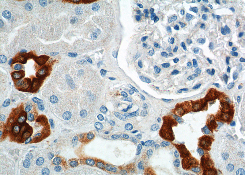 Immunohistochemistry of paraffin-embedded human kidney tissue slide using Catalog No:111140(GPRC5D Antibody) at dilution of 1:100 (under 40x lens).