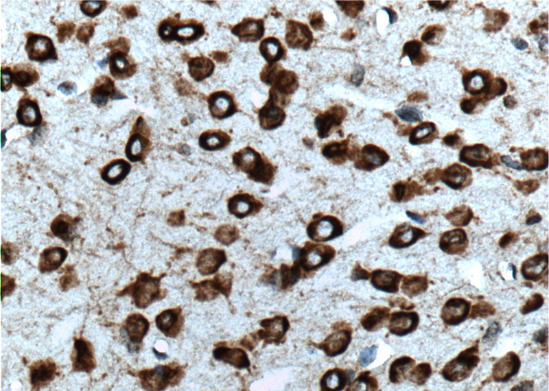 Immunohistochemistry of paraffin-embedded mouse brain tissue slide using Catalog No:107891(ADRA2B-Specific Antibody) at dilution of 1:100 (under 40x lens). heat mediated antigen retrieved with Tris-EDTA buffer(pH9).