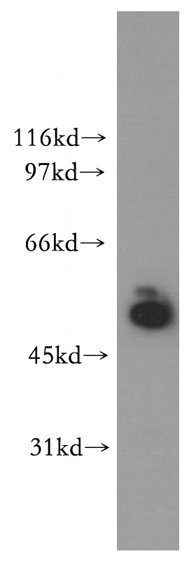 human kidney tissue were subjected to SDS PAGE followed by western blot with Catalog No:115720(STK33 antibody) at dilution of 1:400