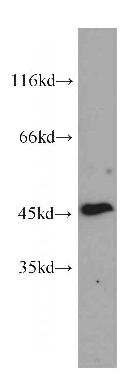 HepG2 cells were subjected to SDS PAGE followed by western blot with Catalog No:107292(GDI2 antibody) at dilution of 1:1000