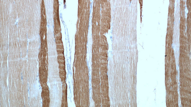 Immunohistochemical of paraffin-embedded human skeletal muscle using Catalog No:112932(MYH2 antibody) at dilution of 1:50 (under 10x lens)