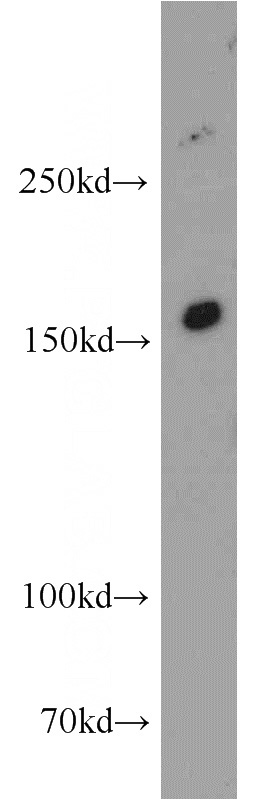 mouse kidney tissue were subjected to SDS PAGE followed by western blot with Catalog No:111852(INSRR antibody) at dilution of 1:500