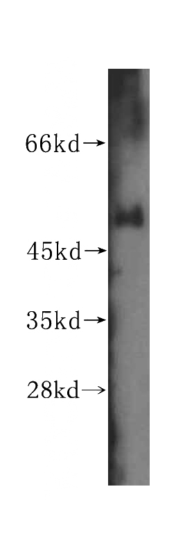 human colon tissue were subjected to SDS PAGE followed by western blot with Catalog No:116970(WRNIP1 antibody) at dilution of 1:500