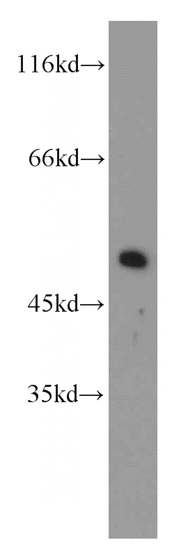 mouse brain tissue were subjected to SDS PAGE followed by western blot with Catalog No:110131(dynactin-2 antibody) at dilution of 1:800